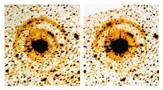 Light echoes around SN 1987A