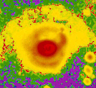 High resolution SN 1987A by NTT
