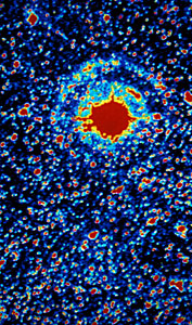 Light echoes from SN 1987A