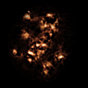 APEX view of the region around the Spiderweb Galaxy