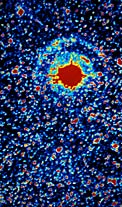Light echoes from SN 1987A