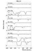 Metal-line System at z=2.18 in Quasar System