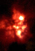 BN/KL Complex in the Orion Nebula