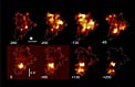 Maps of BzK-15504