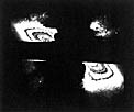 Possible planetary or protoplanetary disc around the star Beta Pictoris
