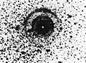 Light echo from Supernova 1987A