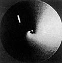 A dust jet from Comet Austin (1989 c1)