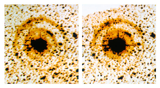 Light echoes around SN 1987A