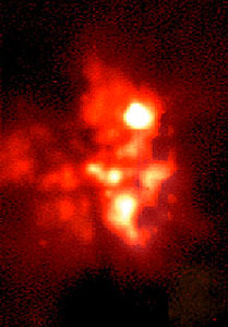 BN/KL Complex in the Orion Nebula