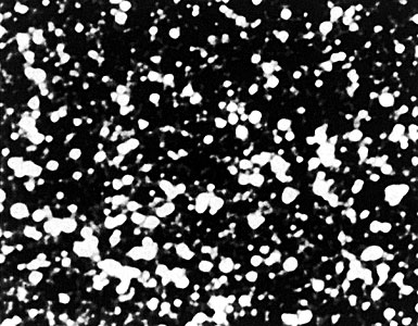 Small field near centre of Omega Centauri (3.6m)