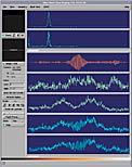 "First Fringes" with two ATs