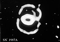 Changes in the Ring Nebula Around SN 1987A