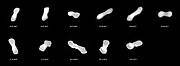 L’astéroïde Kleopatra observé sous divers angles (figure annotée)
